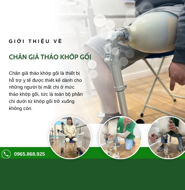 Chân giả tháo khớp gối