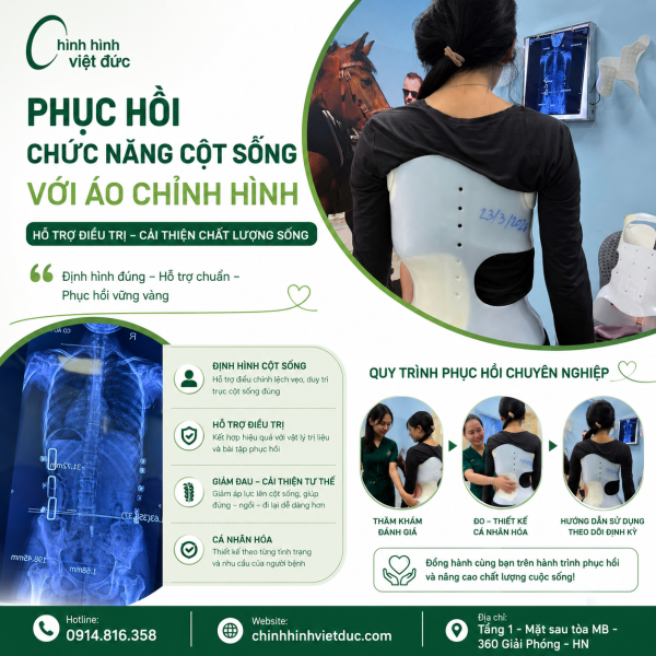 phục hồi chức năng cột sống