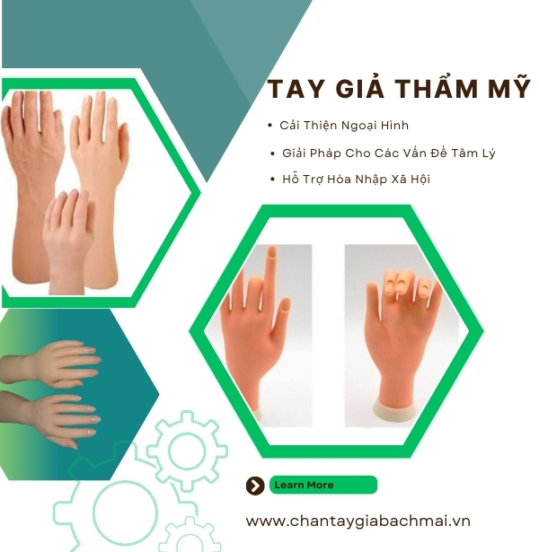 Tay giả thẩm mỹ