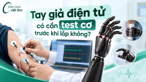 tay giả điện tử có cần test cơ không